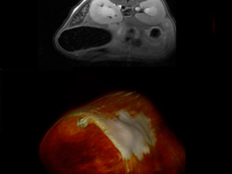 header-Piattaforma-di-Imaging-Biomedico-e-Radiomica-mobile