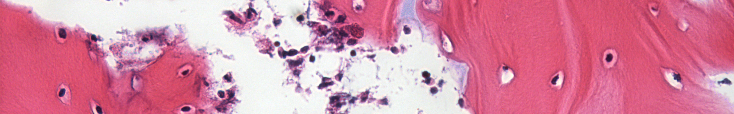 Development-of-an-ex-vivo-stimuli-responsive-osteoarthritis-model-for-drug-testing